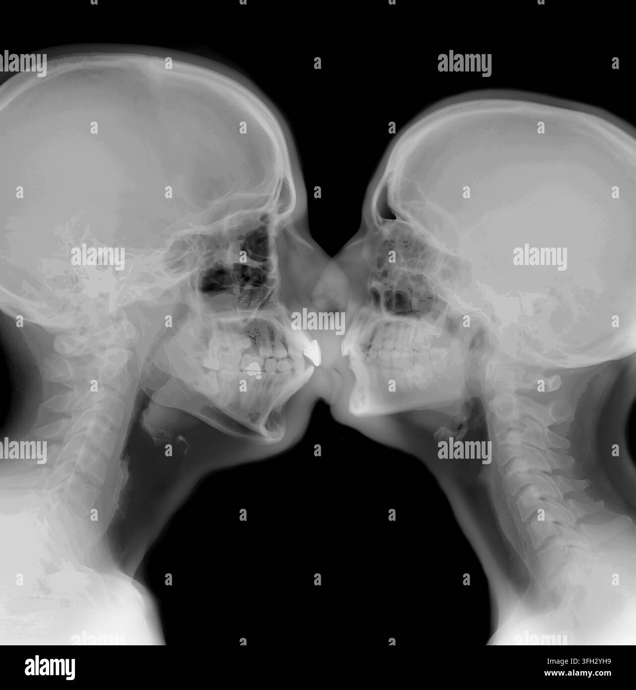 Due teschi umani di profilo si toccano alle labbra, creando una rappresentazione astratta di amore, romanticismo e connessione attraverso la scienza rivelatrice di una Foto Stock