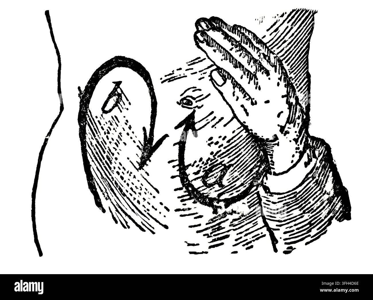 Illustrazione medica storica che mostra una tecnica di massaggio addominale con frecce che indicano il movimento; versione testuale etichettata; stile xilografia vintage ci Foto Stock