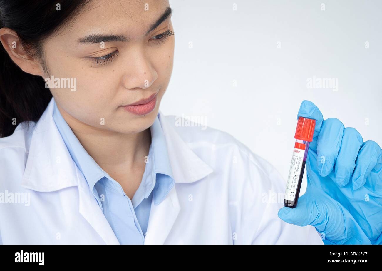Ritratto di una bella giovane donna in camice bianco seduta al posto di lavoro e che lavora con un campione di sangue in un laboratorio medico. Alta risoluzione. Foto Stock