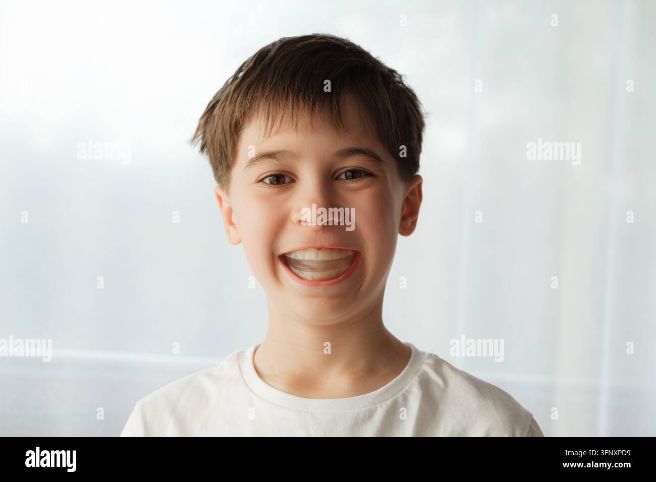 Ritratto di un ragazzo caucasico di dieci anni che sorride con un apparecchio ortodontico in bocca e guarda l'obiettivo. Trattamento ortodontico, cura dentale, igiene orale Foto Stock