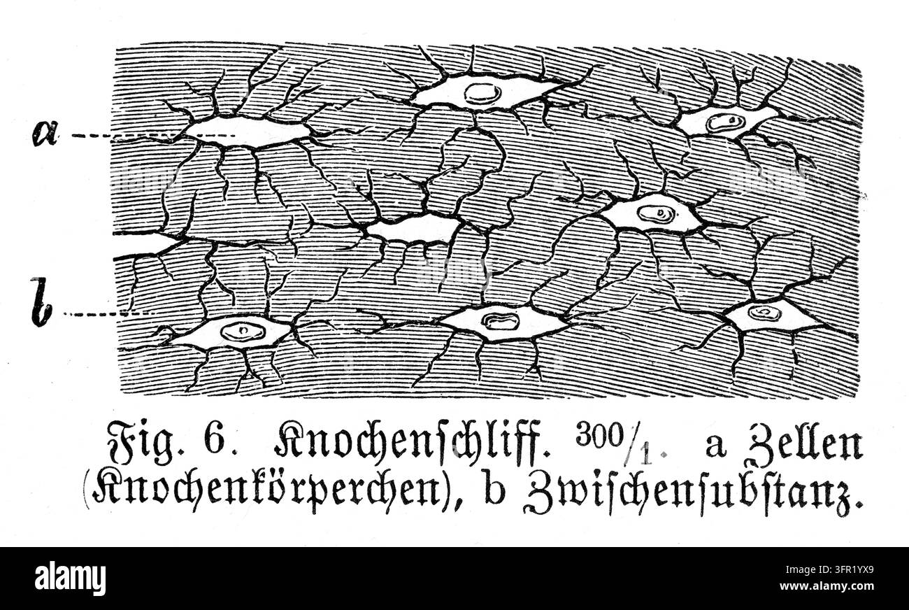 Vista microscopica delle cellule ossee, sostanza intercellulare, studio scientifico, incisione del XIX secolo. Foto Stock