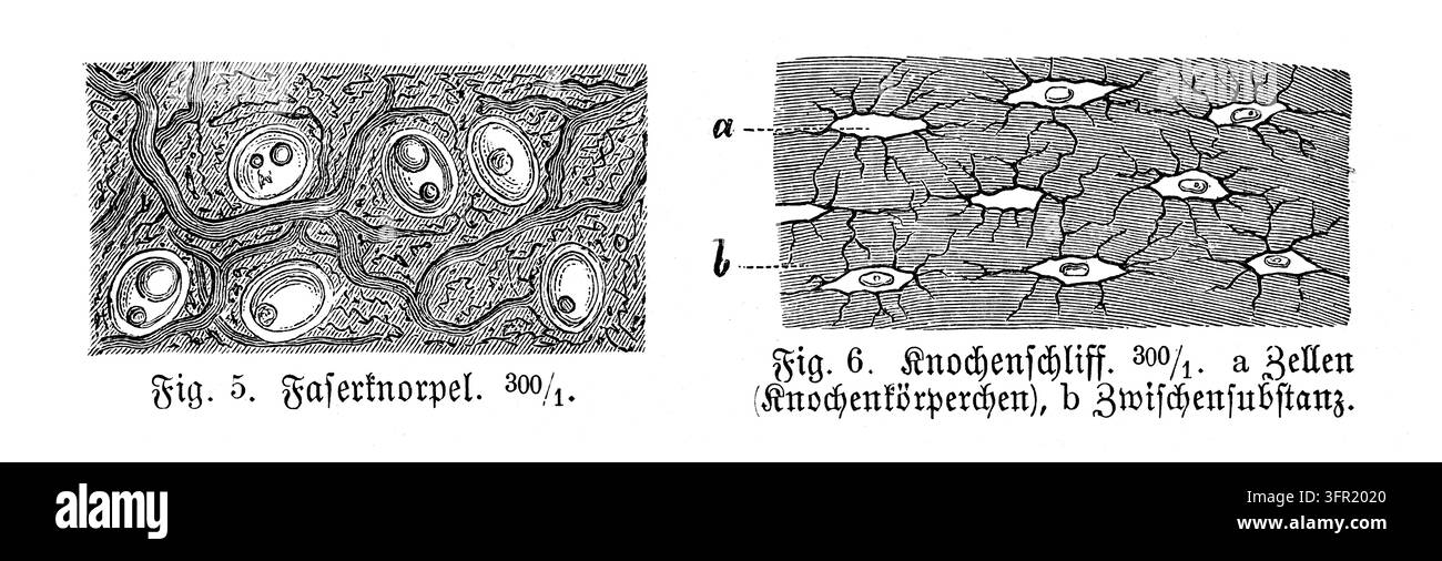 Cartilagine fibrosa e tessuto osseo, studio anatomico microscopico, illustrazione scientifica, incisione del XIX secolo. Foto Stock