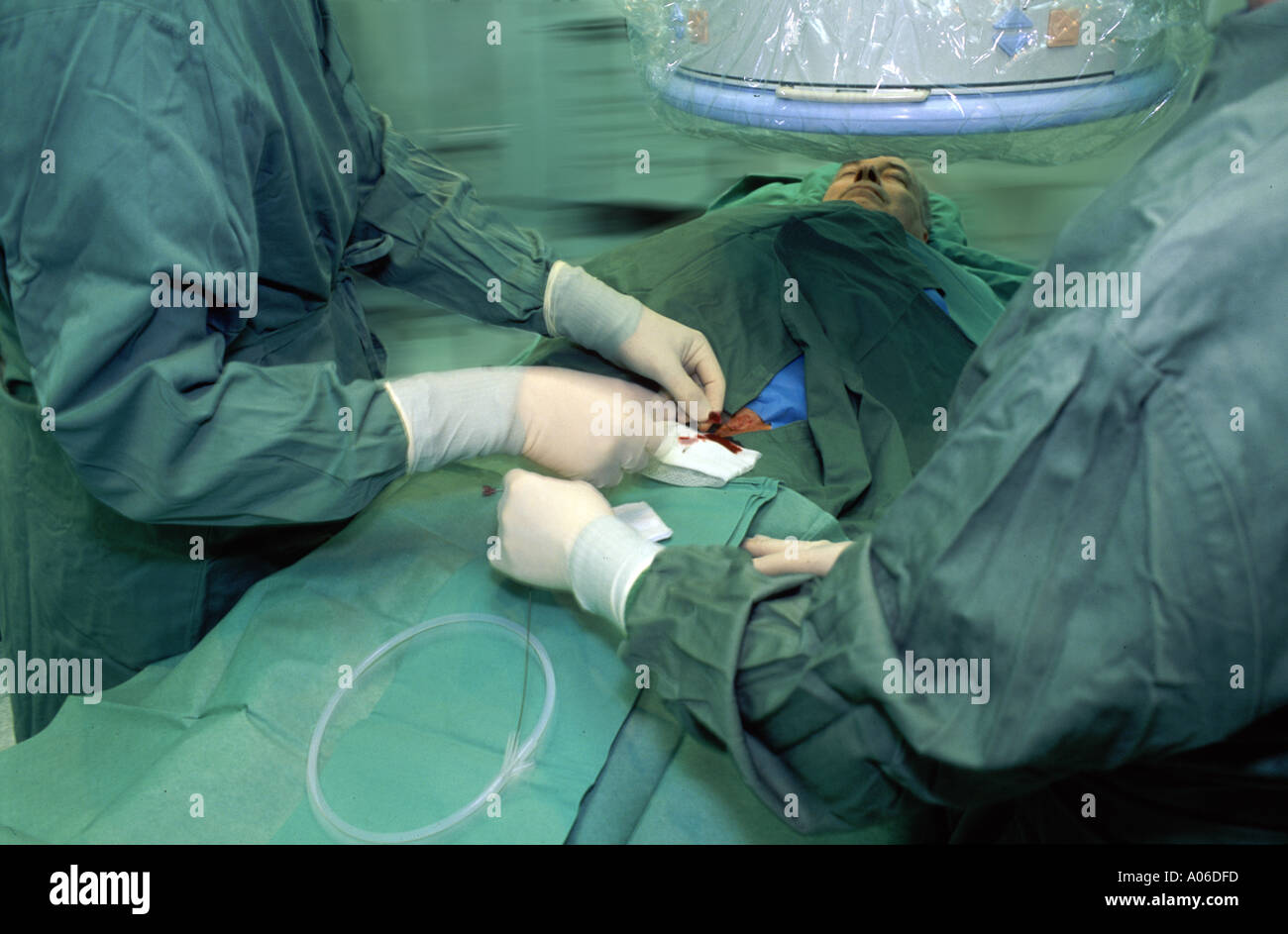 I chirurghi di eseguire la cateterizzazione dell aortha Foto Stock
