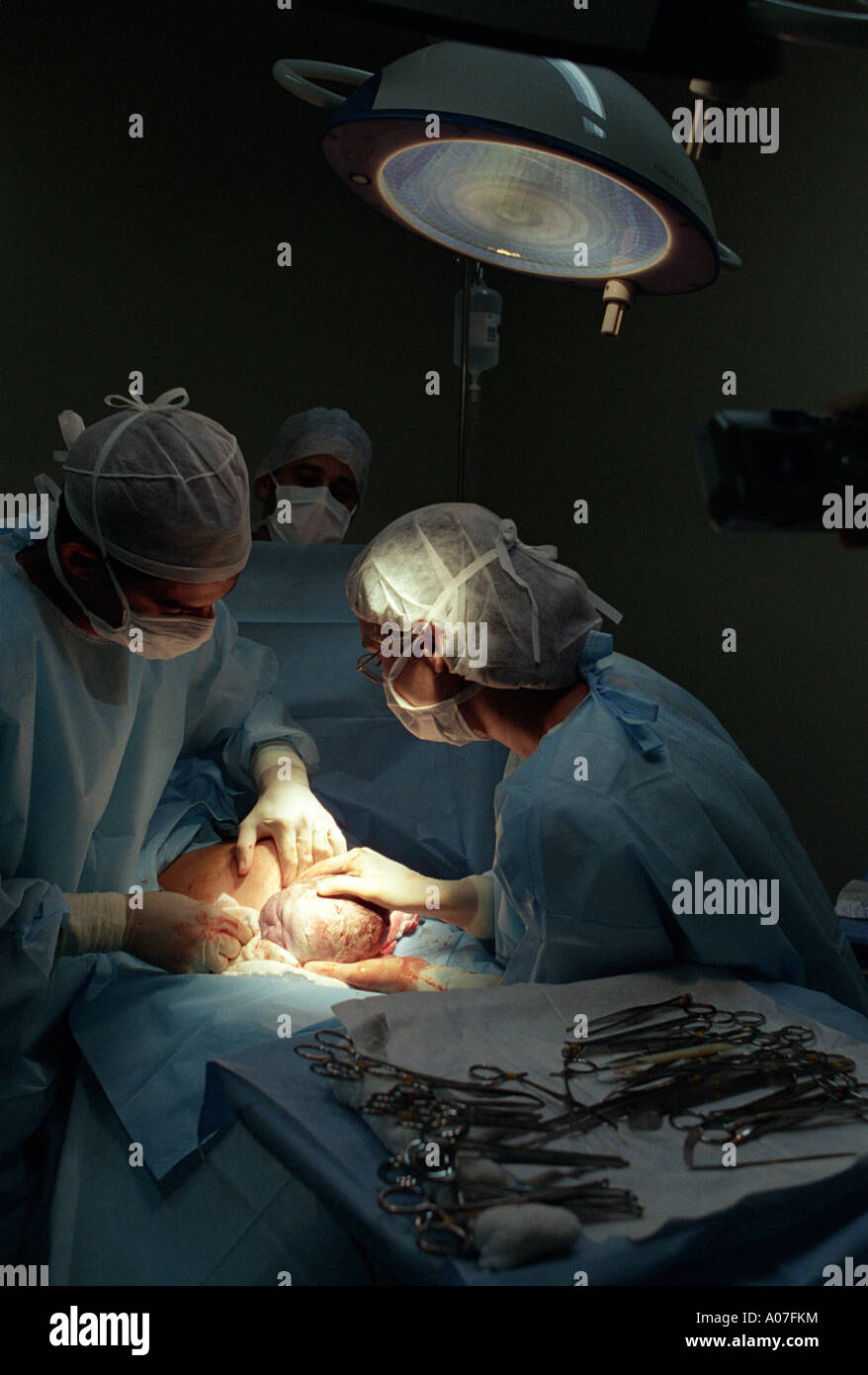 Parto consegna ospedale di maternità della donna la nascita di un bambino i medici effettuare un intervento chirurgico di taglio cesareo Foto Stock