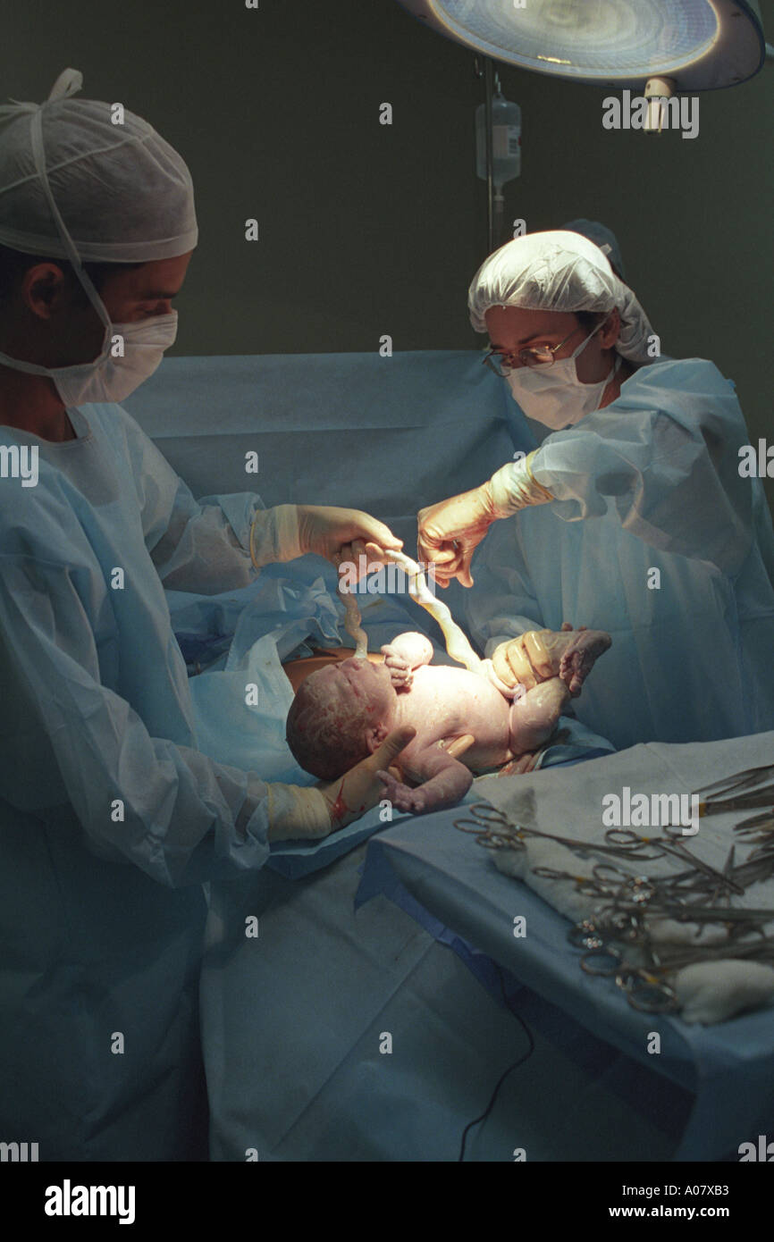 Parto consegna ospedale di maternità della donna la nascita di un bambino i medici effettuare un intervento chirurgico di taglio cesareo Foto Stock