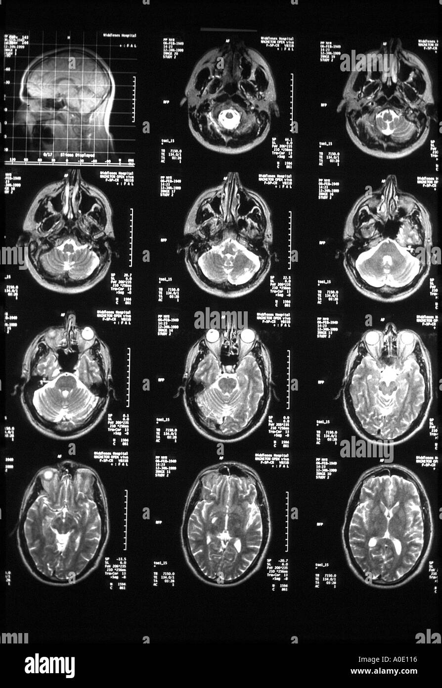 Esplorazione del cervello Foto Stock