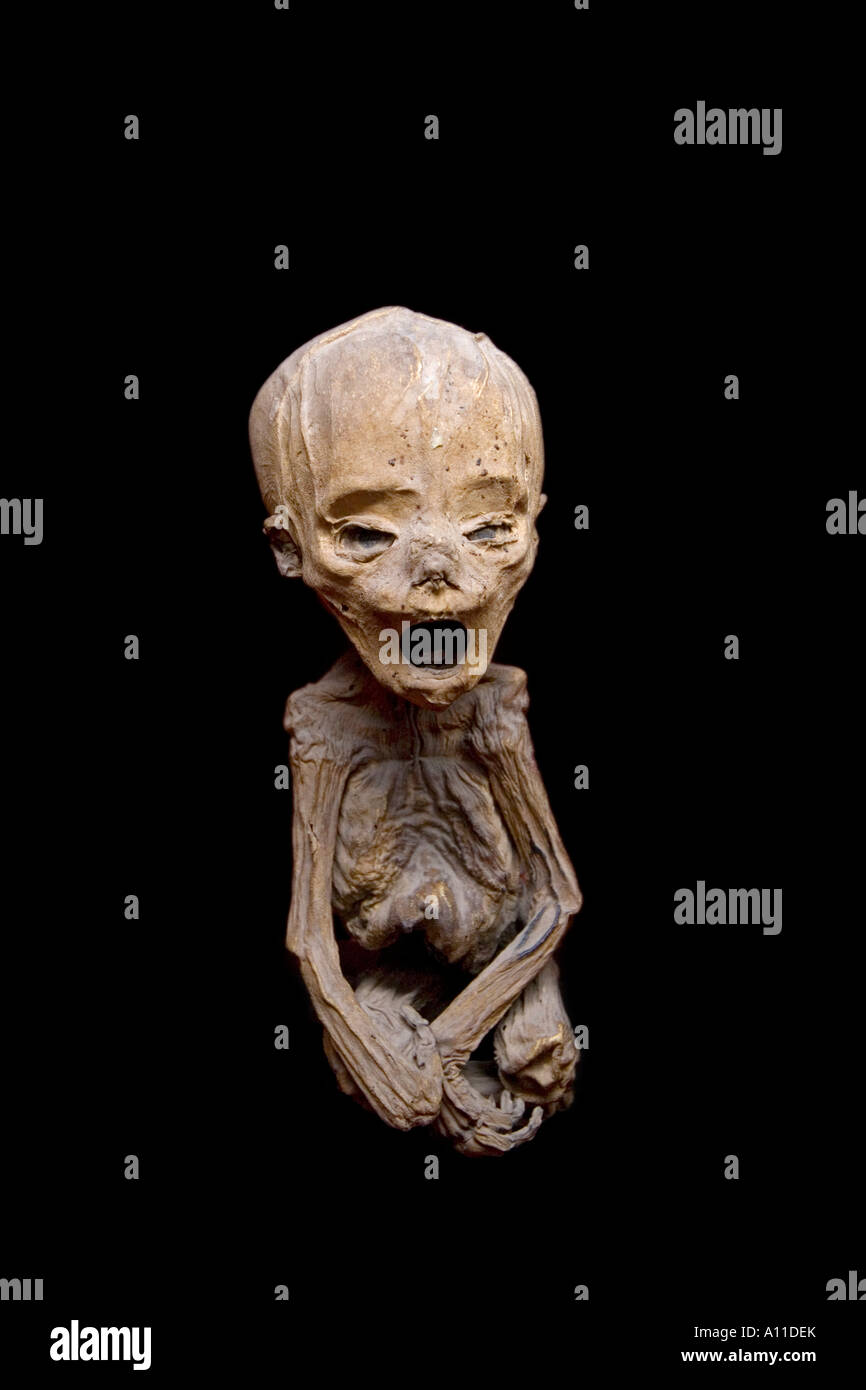 Un bambino mummificato nel Museo delle Mummie (Guanajuato - Messico). Momie d'enfant du 'Museo de las Momias' (Guanajuato - Mexique) Foto Stock