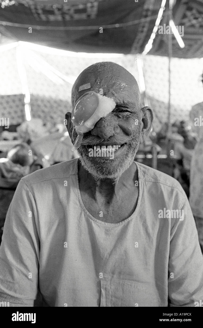 Uomo anziano che si sta riprendendo dalla chirurgia della cataratta in una clinica temporanea di viaggio degli occhi nella Rajasthan rurale, India Foto Stock