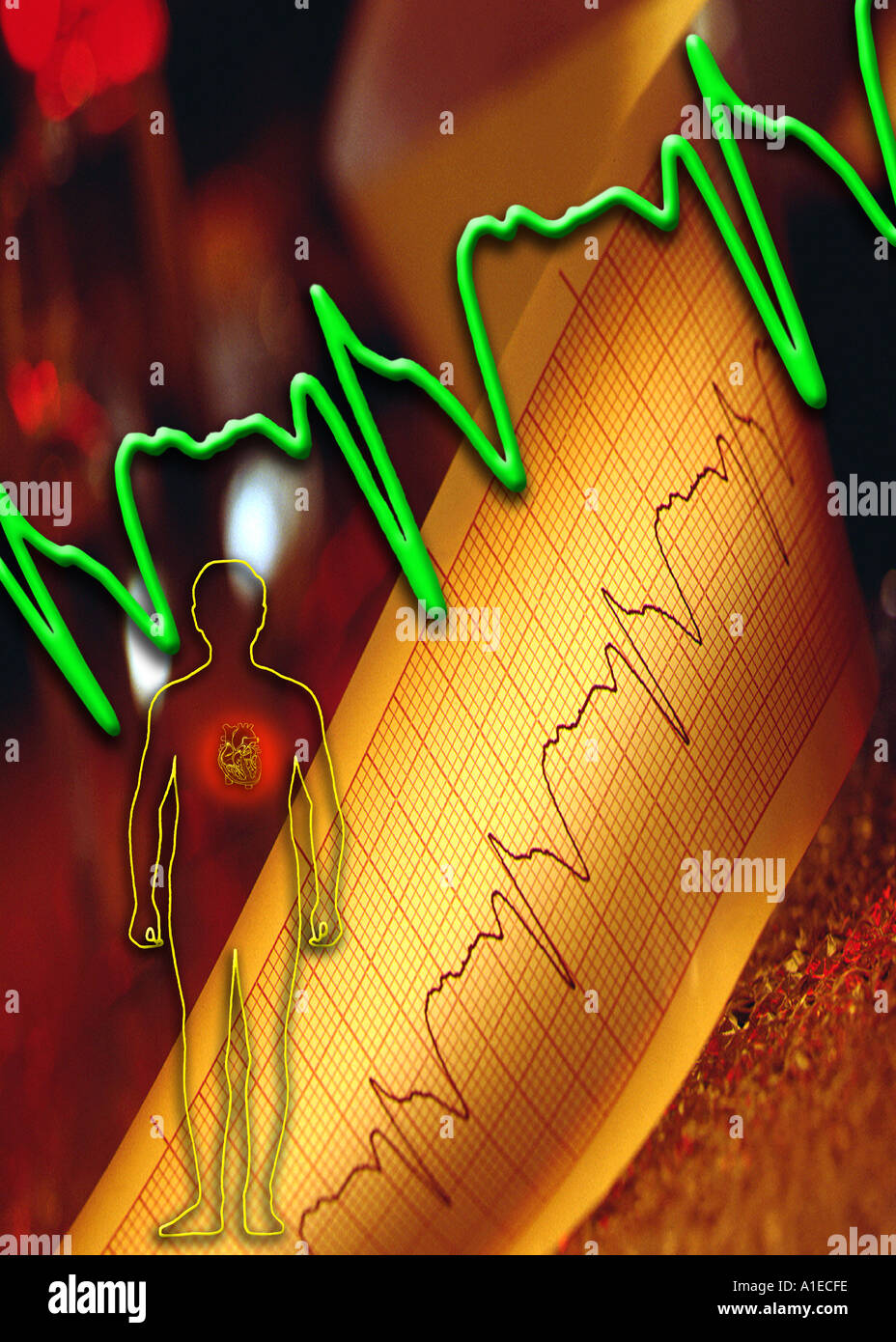 Cardiologia - ECG (elettrocardiografo) trace Foto Stock