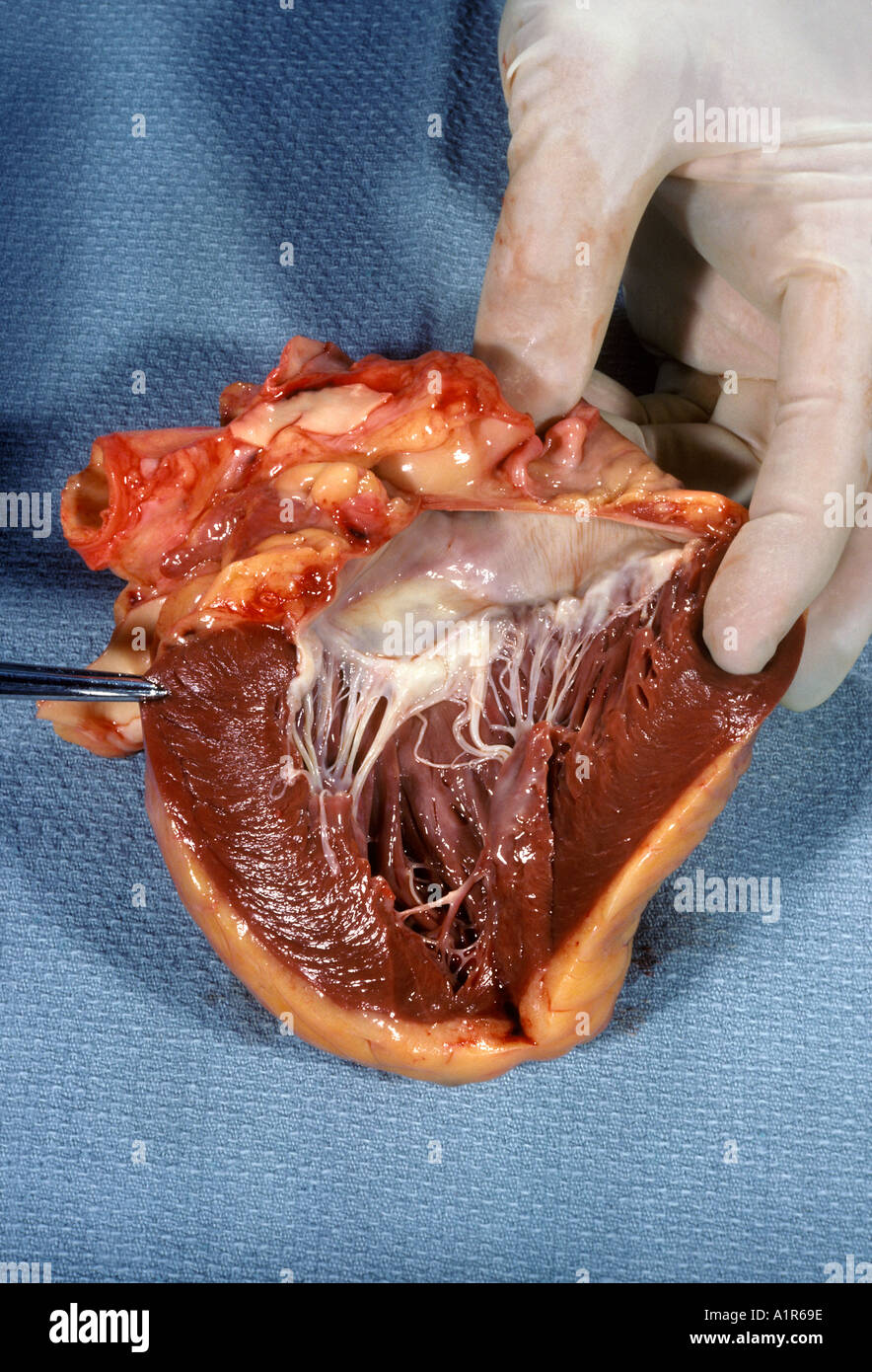 Cuore umano che mostra l'endocardio miocardio e la valvola mitrale. Foto Stock