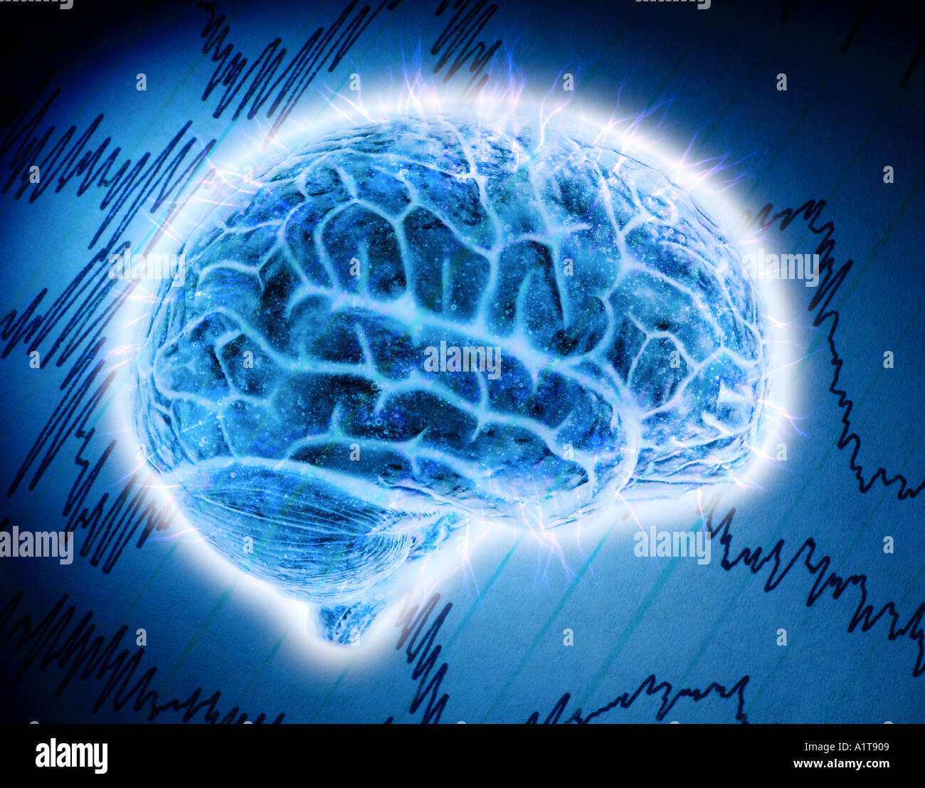 Modello di un cervello con un elettroencefalogramma stampa in background Foto Stock