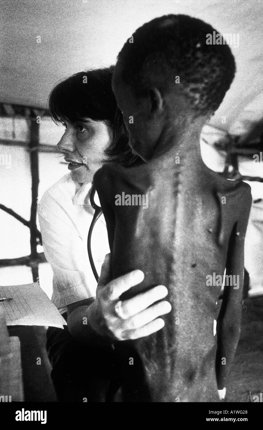 Ajiep camp,Sud Sudan,Aiuto worker esamina bambino con grave stato di malnutrizione. Foto Stock