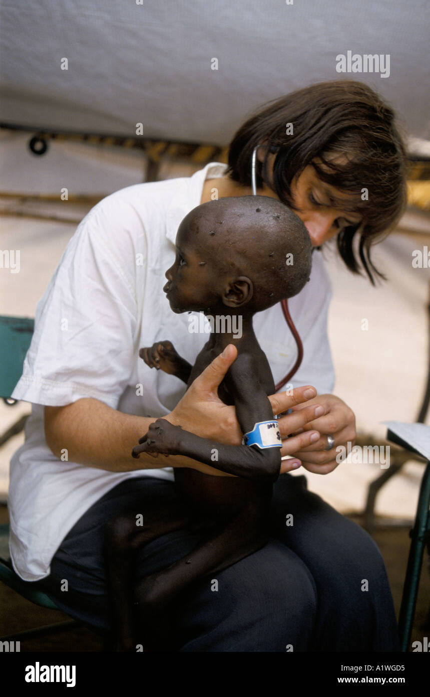 La carestia Medecins sans frontieres (MSF )medico belga LU NAKIL trattare gravemente malnutriti bambino 1998 Foto Stock