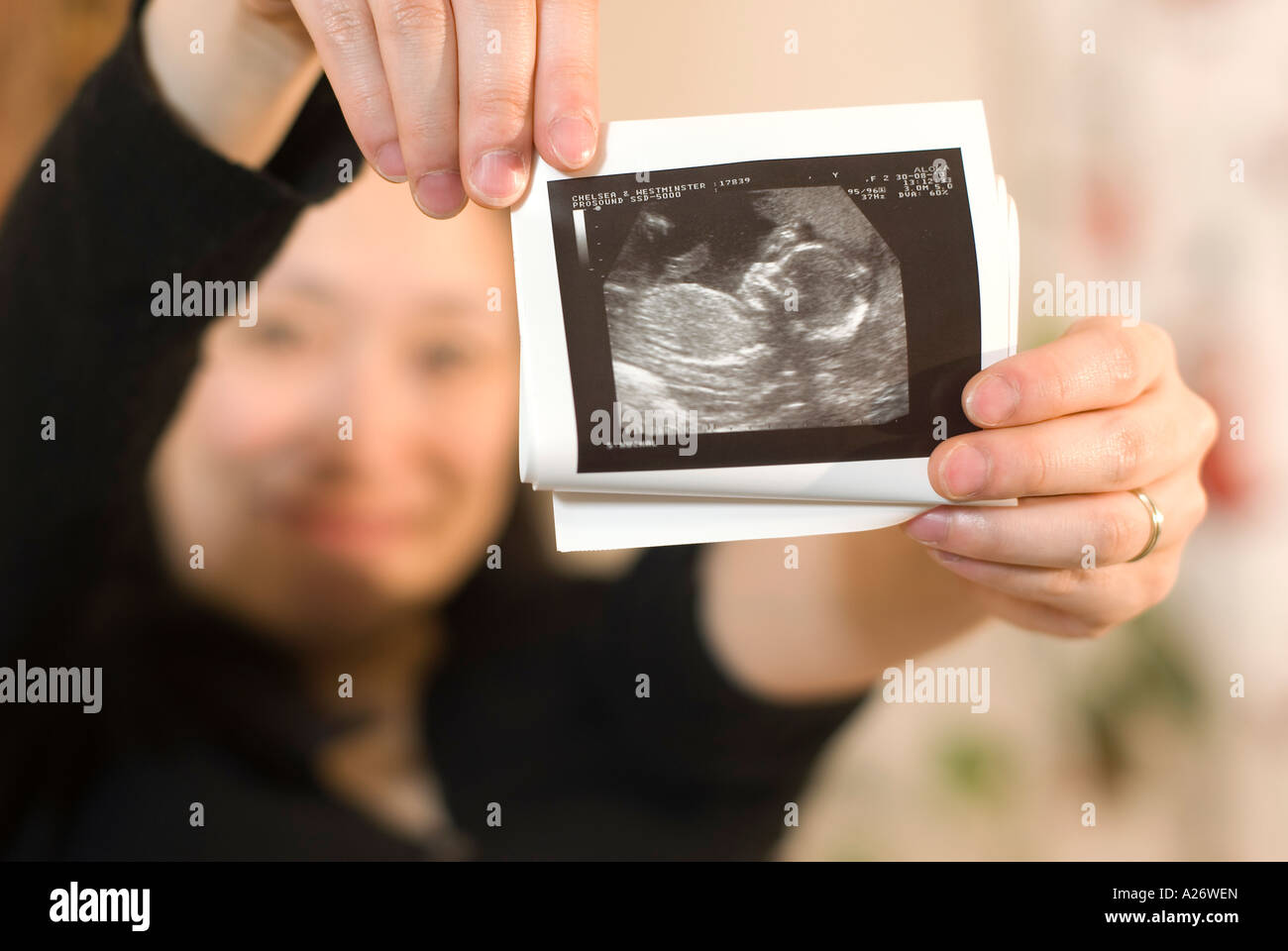 Donna Giapponese tenendo fuori la scansione a ultrasuoni stampa del suo bambino per eseguire la scansione in una messa a fuoco nitida madre in soft focus dietro Foto Stock