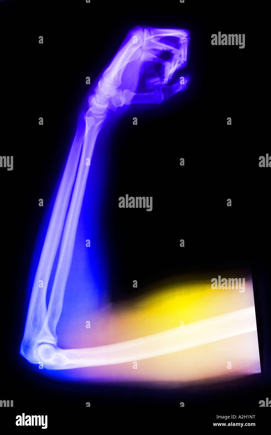 Colorato di raggi X un braccio mans flettendo il suo muscolo bicipite Foto Stock