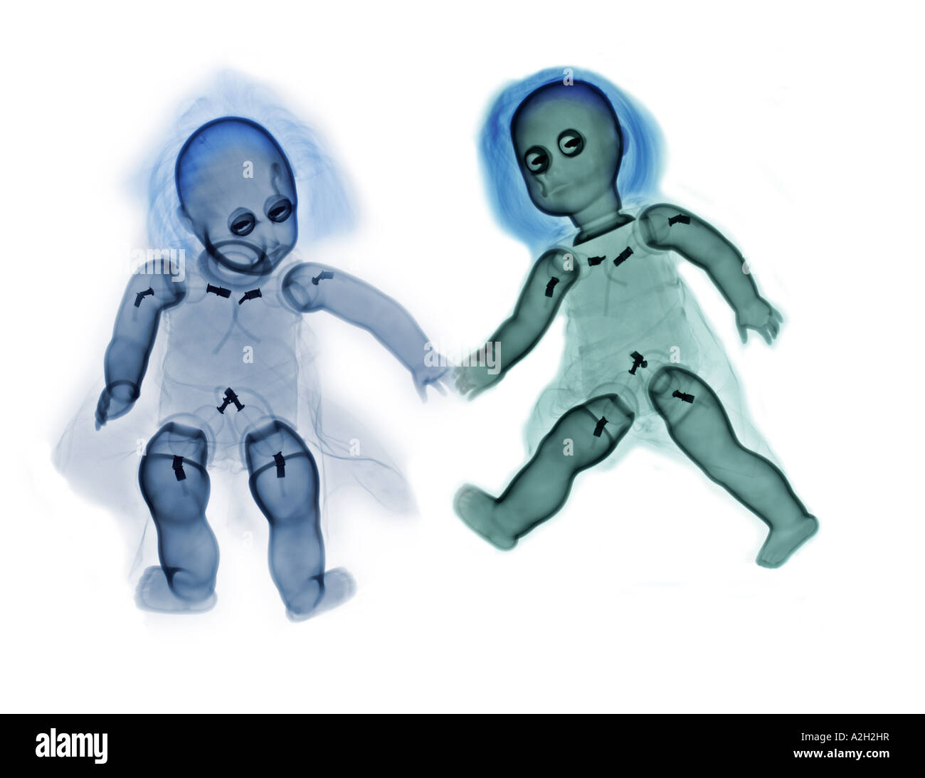 Colorizzato xray di un bambino bambole Foto Stock