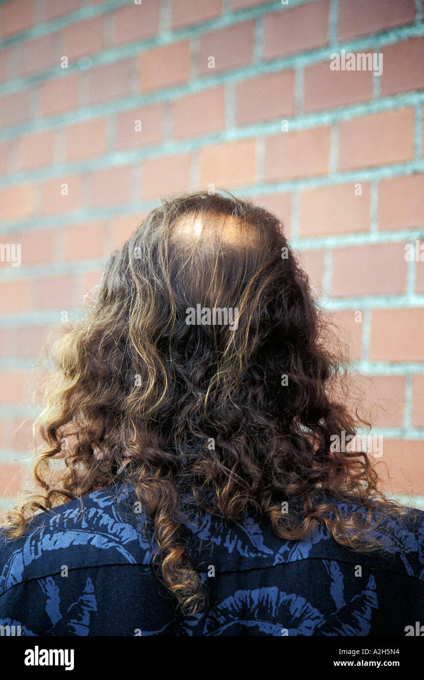 Vista posteriore dell'uomo s con testa calva e spot spallamento lungo la lunghezza dei capelli ricci. La calvizie maschile. Foto Stock