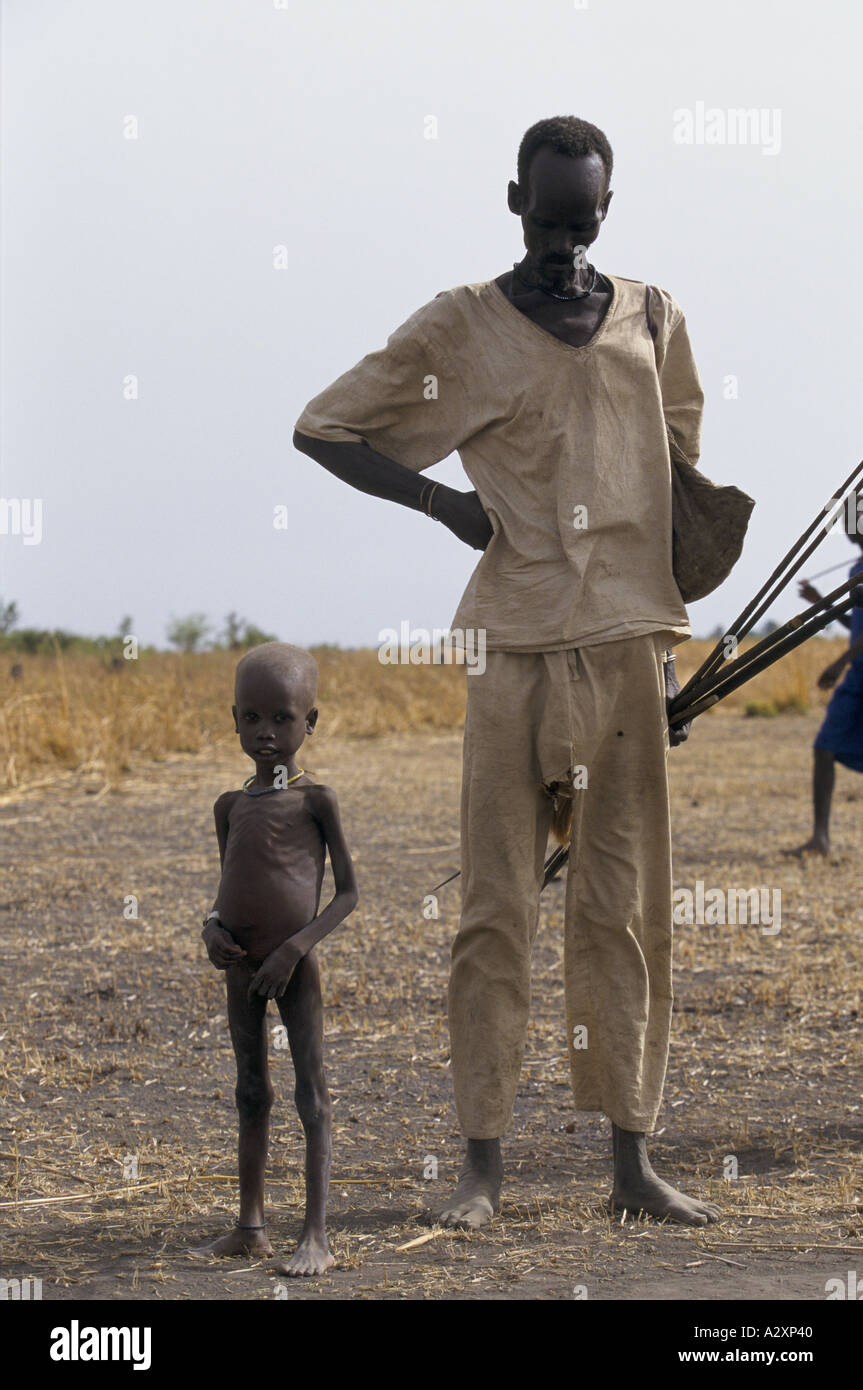 Sudan imminente carestia di malnutriti uomo e bambino 1998 Foto Stock