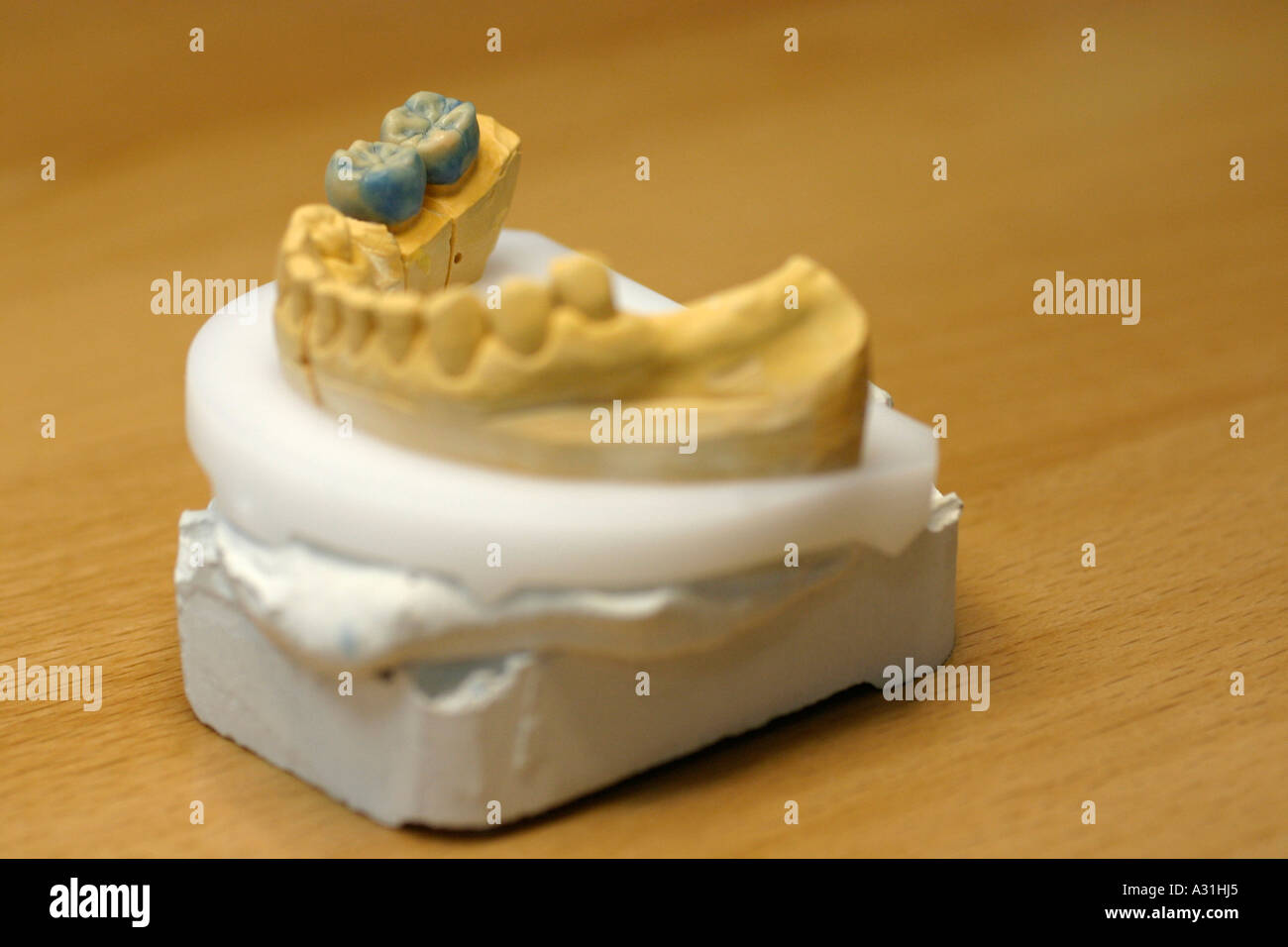 Giallo stampo dentale Foto Stock
