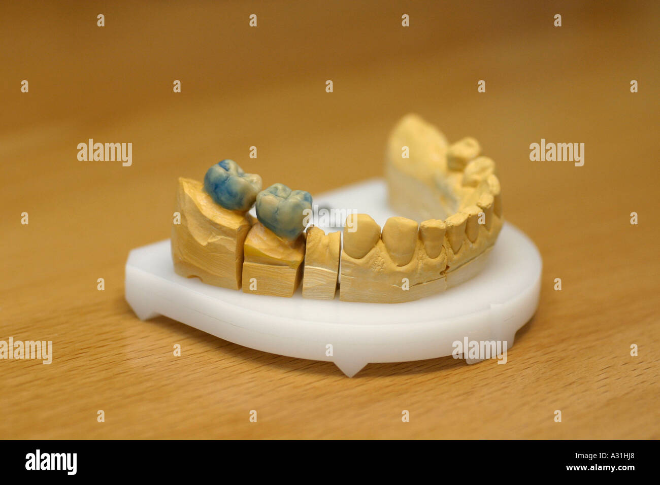 Giallo stampo dentale close up Foto Stock