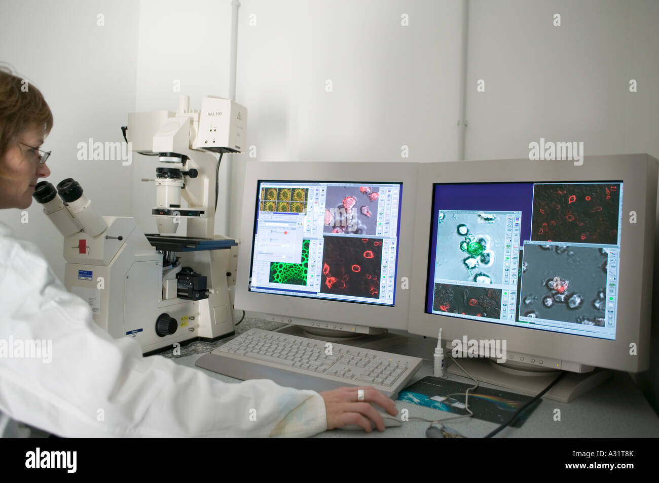 Microscopio a scansione laser immagini e fotografie stock ad alta ...