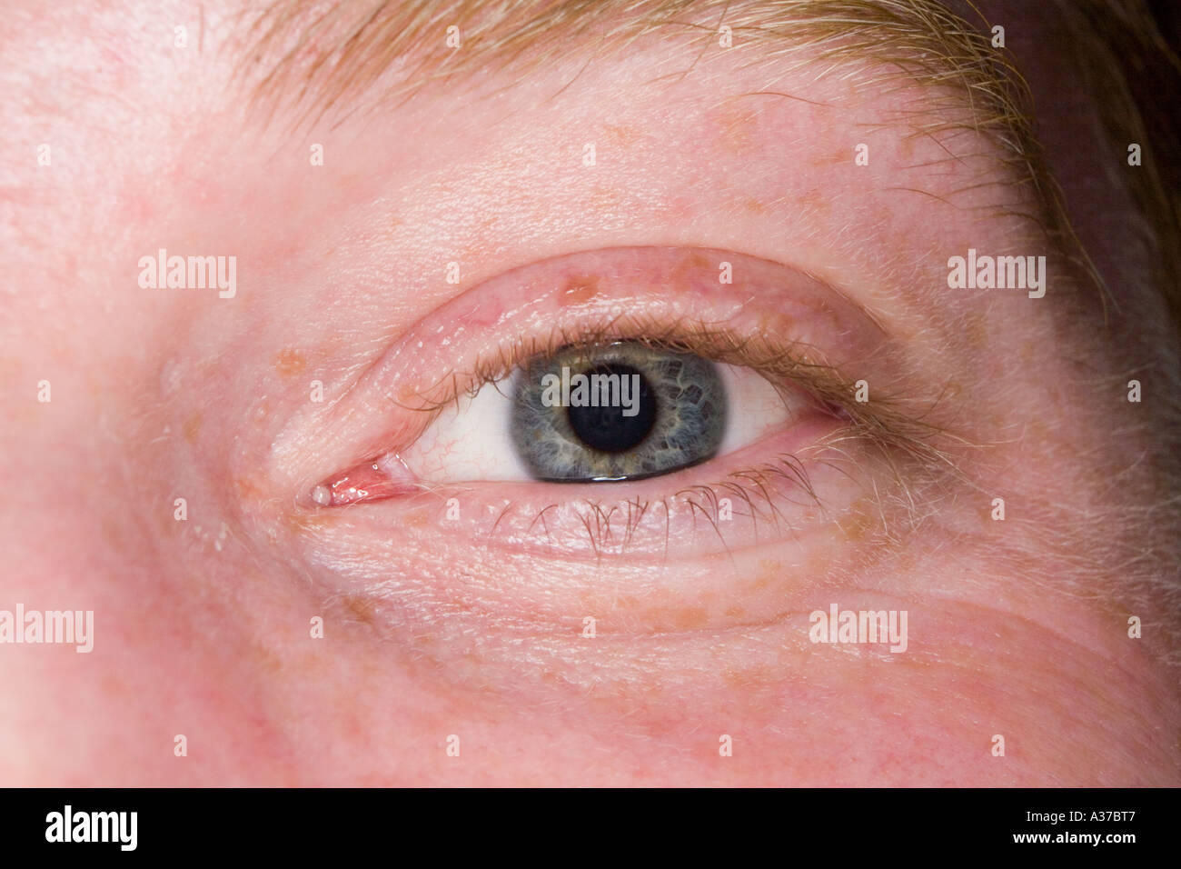 Close up di un occhio in presa con una corona di flash Foto Stock