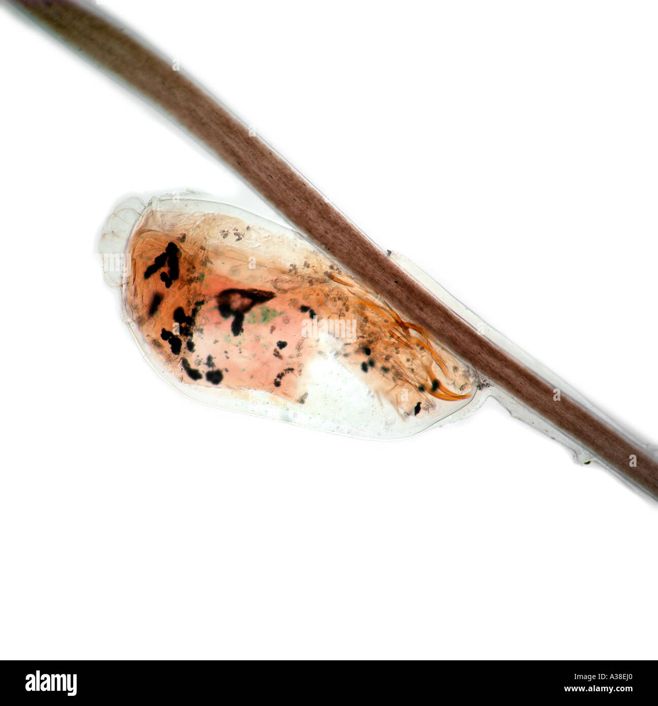 Sviluppo di testa umana pidocchio uovo sulla ciocca di capelli Pediculus capitis de Geer Foto Stock