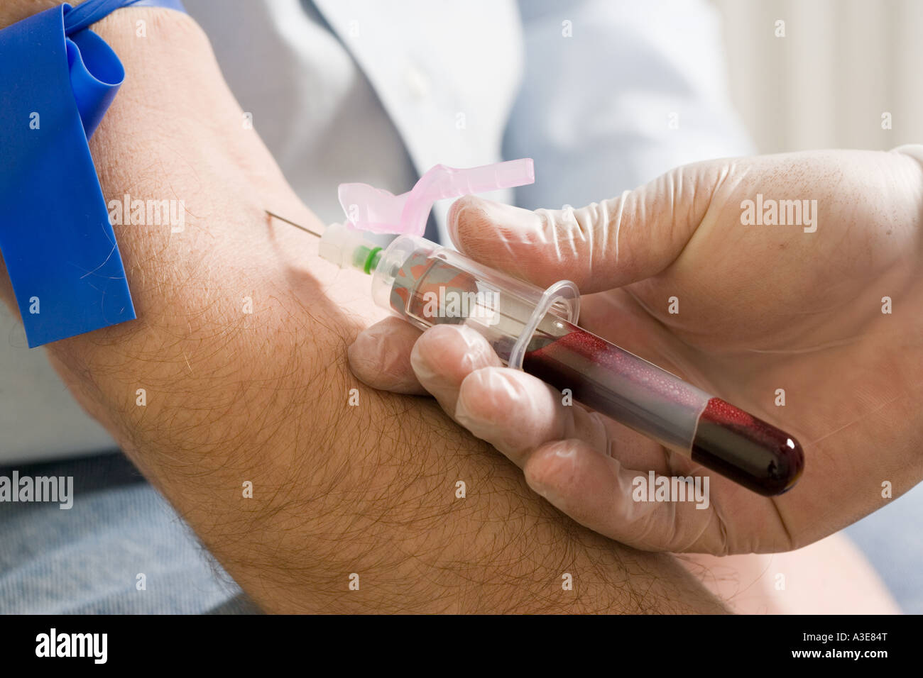La raccolta di campioni di sangue per il test del sangue.Il prelievo di sangue. Foto Stock