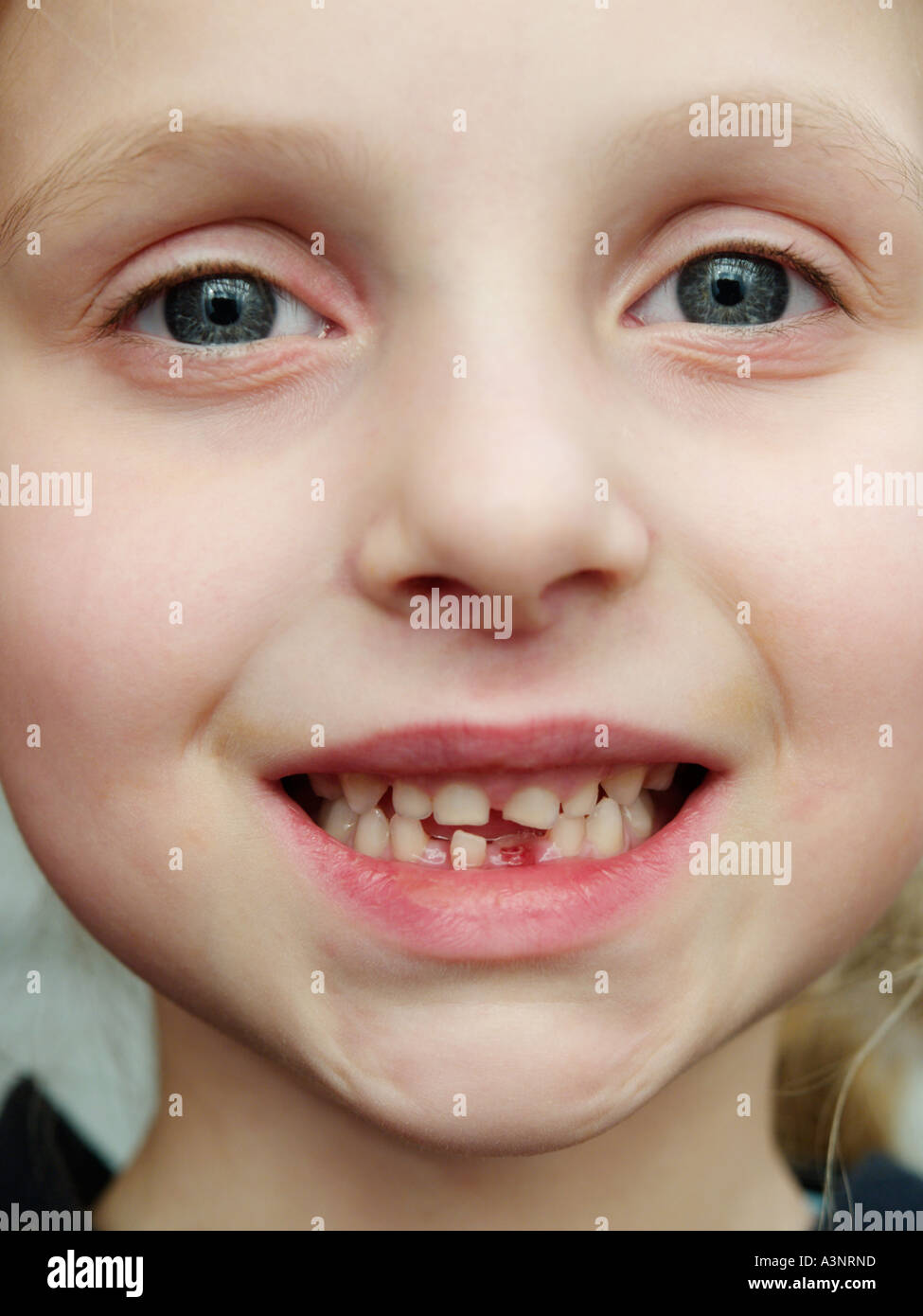 Ritratto di orgogliosa bambina 5 cinque anni con il primo dente che è caduto fuori modifica capannone denti dente dente perduto Foto Stock