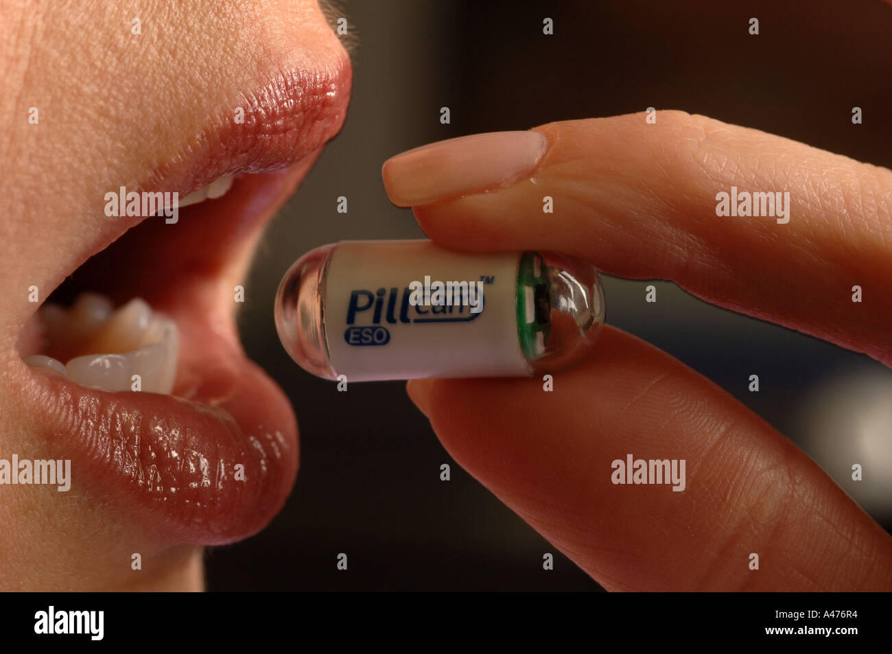 Paziente inghiotte Pillcam minuscola telecamera in una capsula che rende le  immagini di stomaco e intestino e aiuta nella diagnosi Foto stock - Alamy
