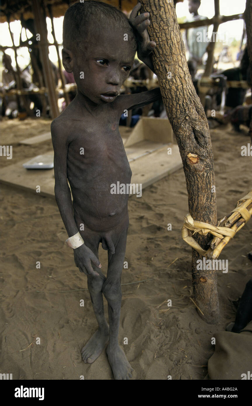 La carestia nel Sudan meridionale sans medicina clinica di frontiera malnorished boy attende per il trattamento Foto Stock