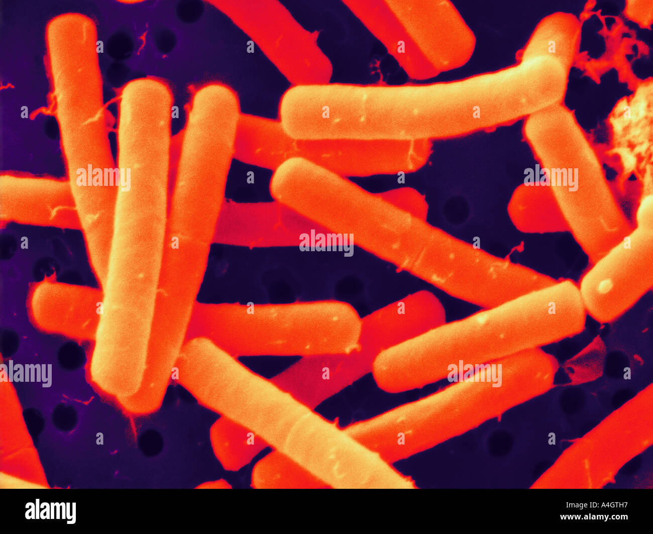 Questo è un colore enhanced scanning electron microfotografia del batterio del suolo Bacillus cereus Foto Stock