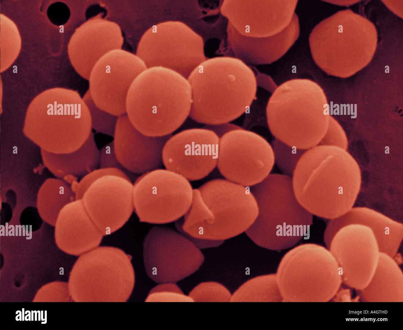 Questo è un colore enhanced scanning electron microfotografia di Staphylococcus aureus. Foto Stock