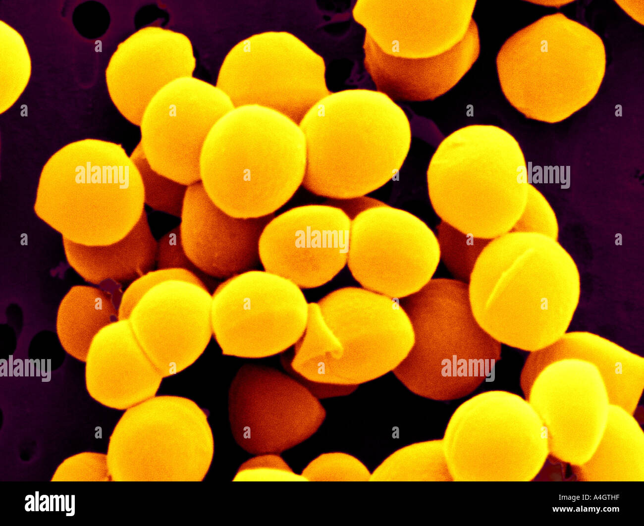 Questo è un colore enhanced scanning electron microfotografia di Staphylococcus aureus. Foto Stock