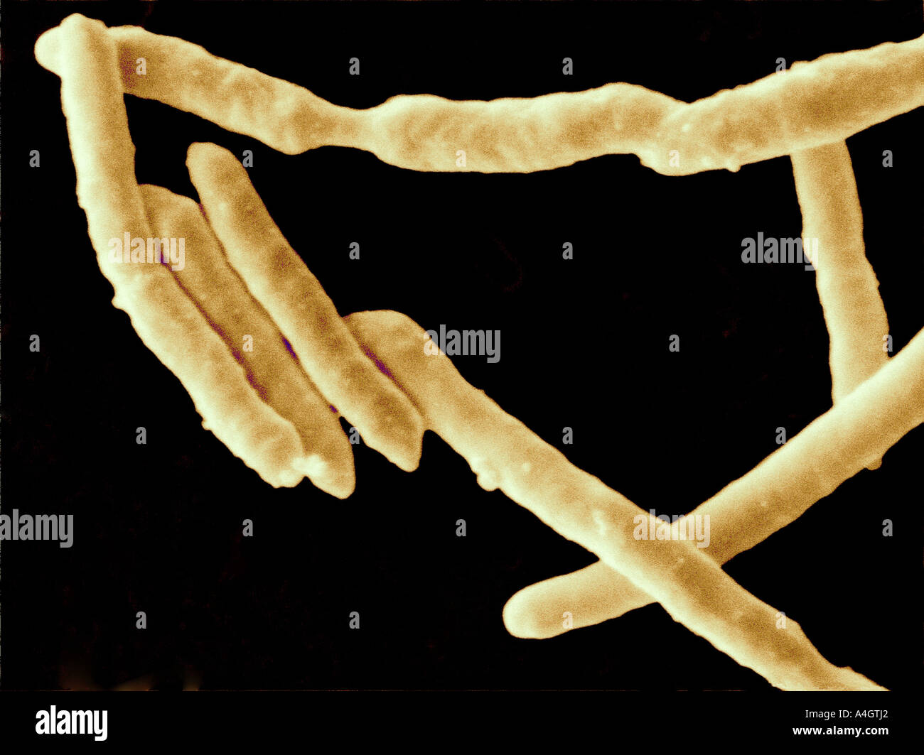 Questa è una micrografia elettronica a scansione della Yersinia enterocolitica. Y enterocolitica appartiene a una famiglia di astiformi di batteri Foto Stock