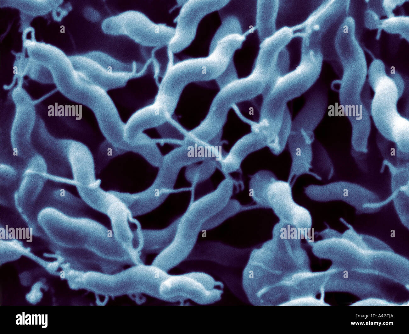 Questo è un colore enhanced scanning electron microfotografia del batterio Campylobacter jejuni Foto Stock