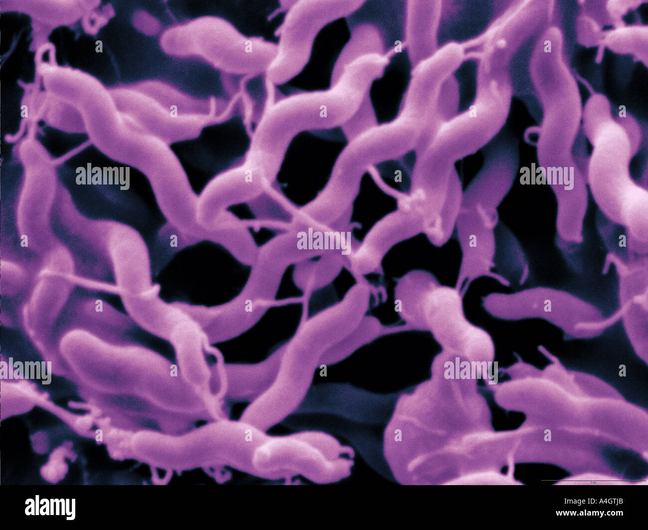 Questo è un colore enhanced scanning electron microfotografia del batterio Campylobacter jejuni Foto Stock