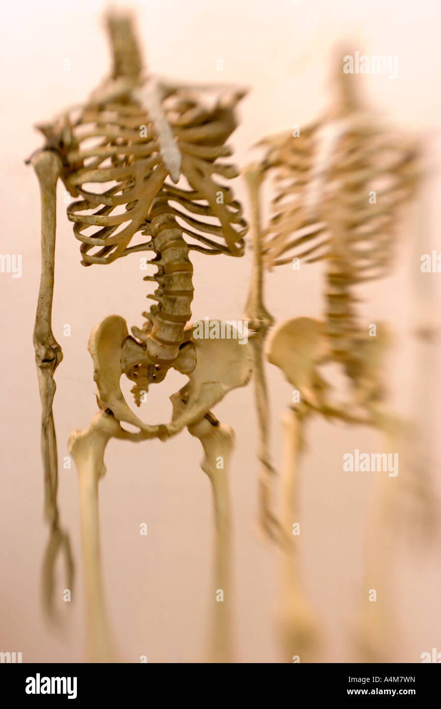 Due decapitati scheletri umani in piedi contro uno sfondo semplice Foto Stock