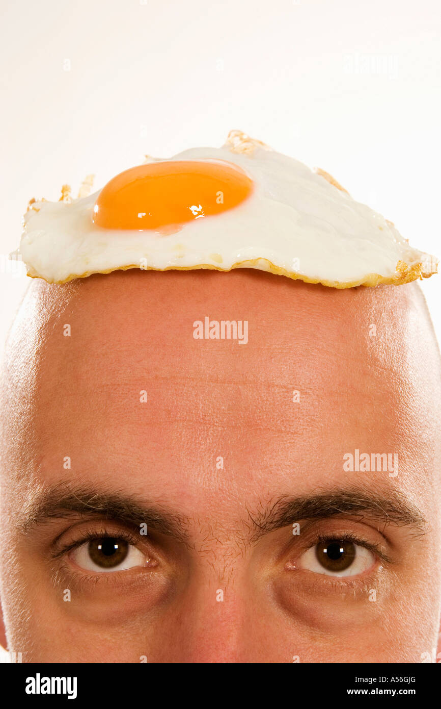 Uomo con uovo fritto sulla testa Foto Stock