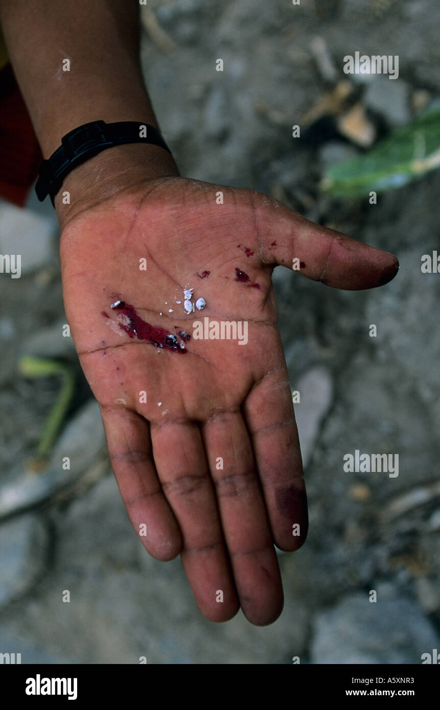 Cocciniglie (Dactylopius coccus Costa) nella mano di un connazionale (Perù). Cochenilles dans la main d'onu paysan (Pérou). Foto Stock