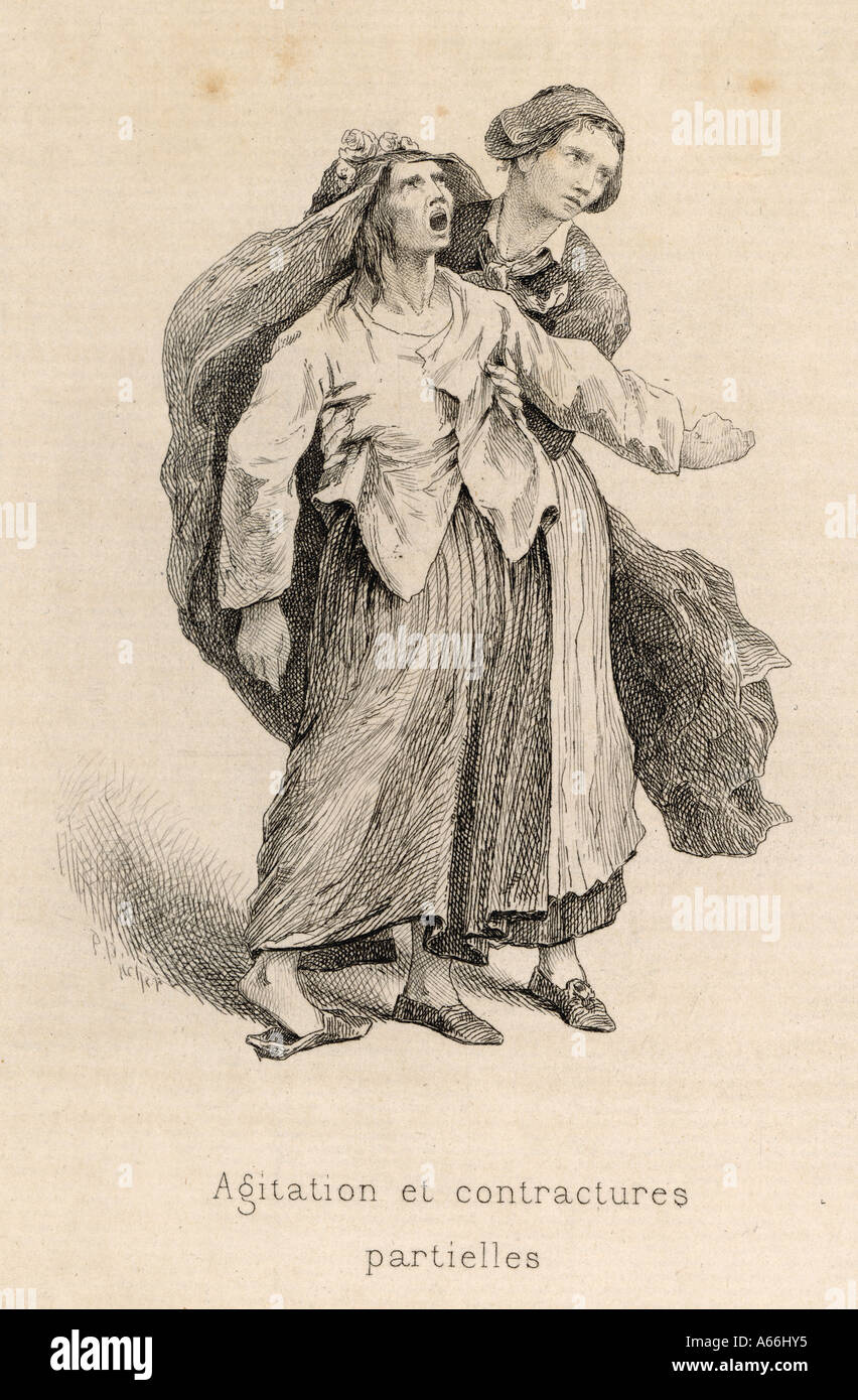 La follia isteria 1881 Foto Stock