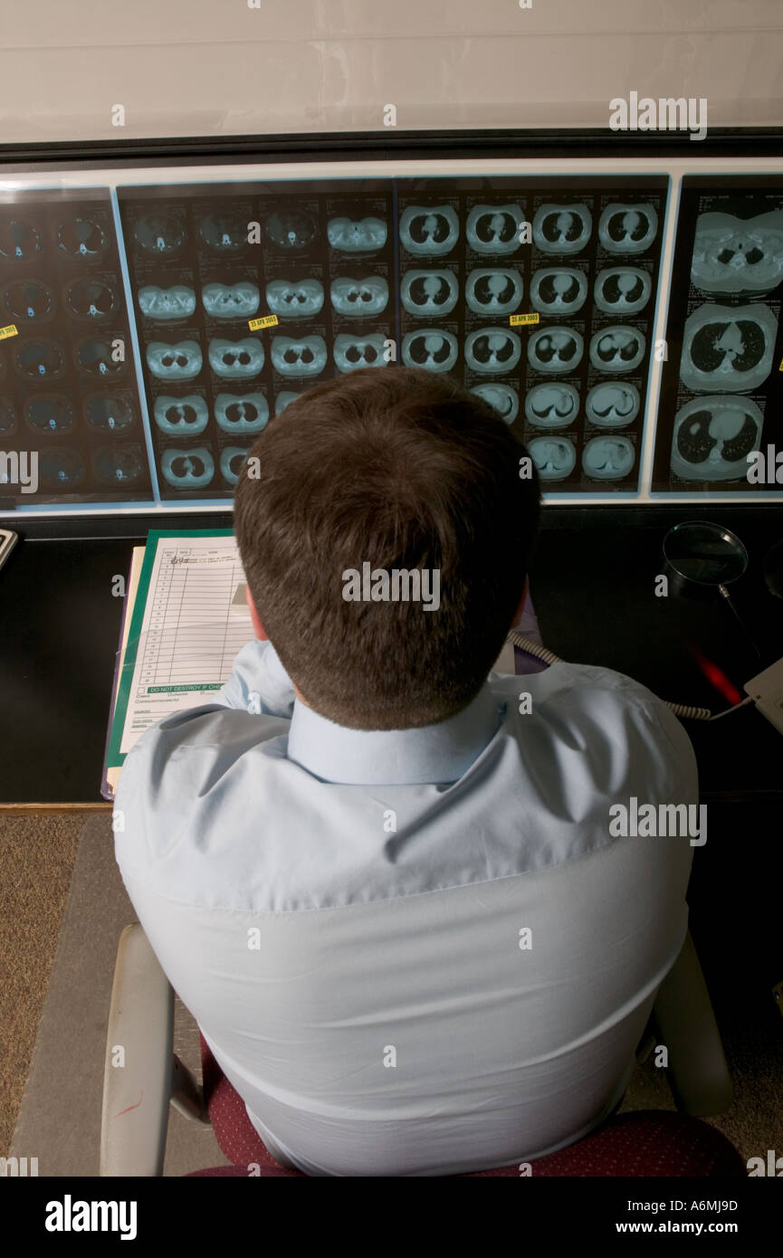 Maschio di valutazione da parte del radiologo di esami di lastre e di dettare le sue osservazioni e diagnosi Foto Stock