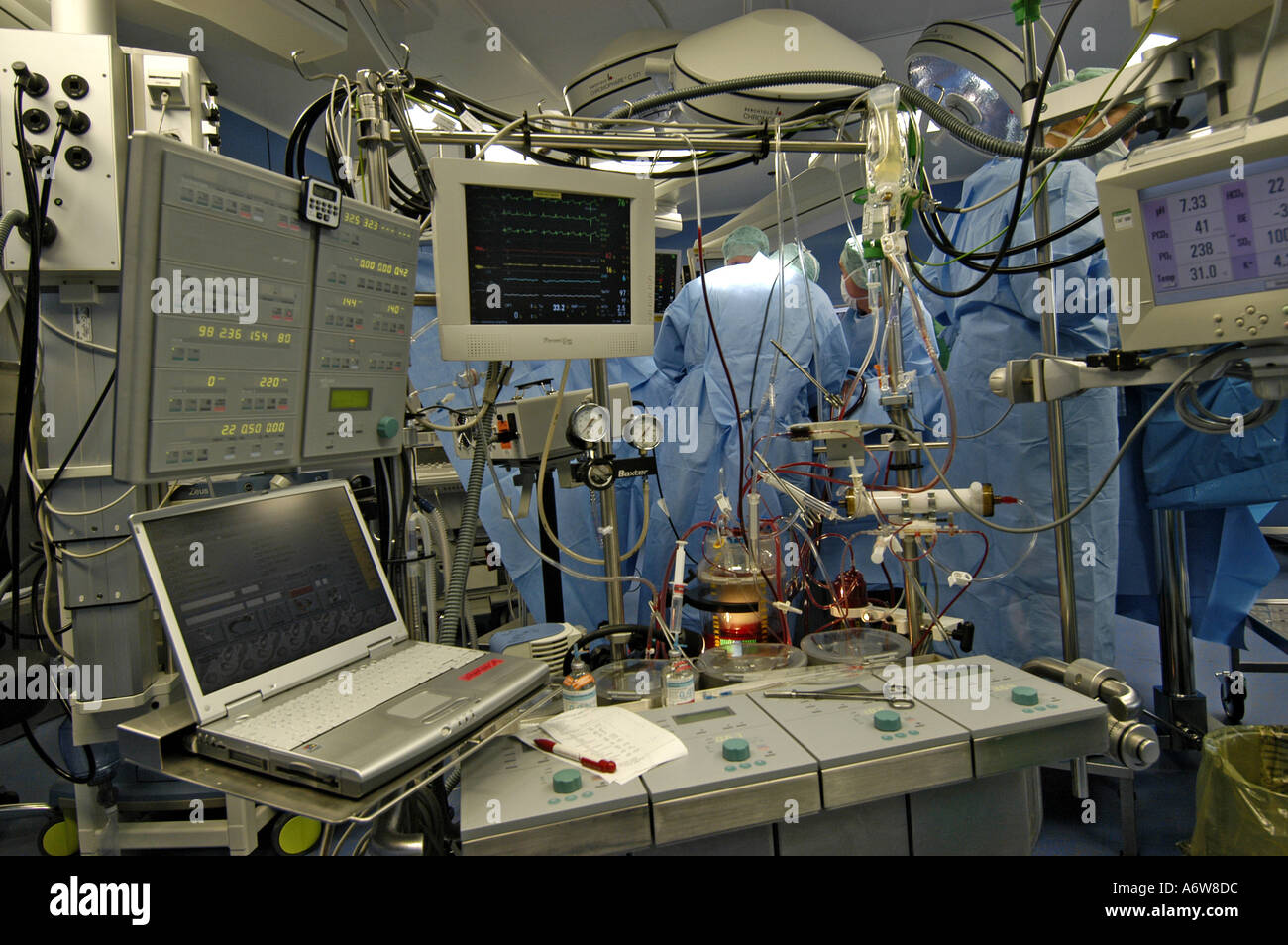 DEU Deutschland Westdeutsches Herzzentrum Essen Klinik fuer Thorax und Kardiovaskulare Chirurgie Herz Lungen Maschine DEU Germania Essen Centro di cuore della Germania Ovest clinica per torace e chirurgia cardiovascolare rianimazione cardiopolmonare WICHTIG Fotos duerfen nicht fuer Werbung PR anderer Kliniken Krankenhaeuser eingesetzt werden Foto Stock