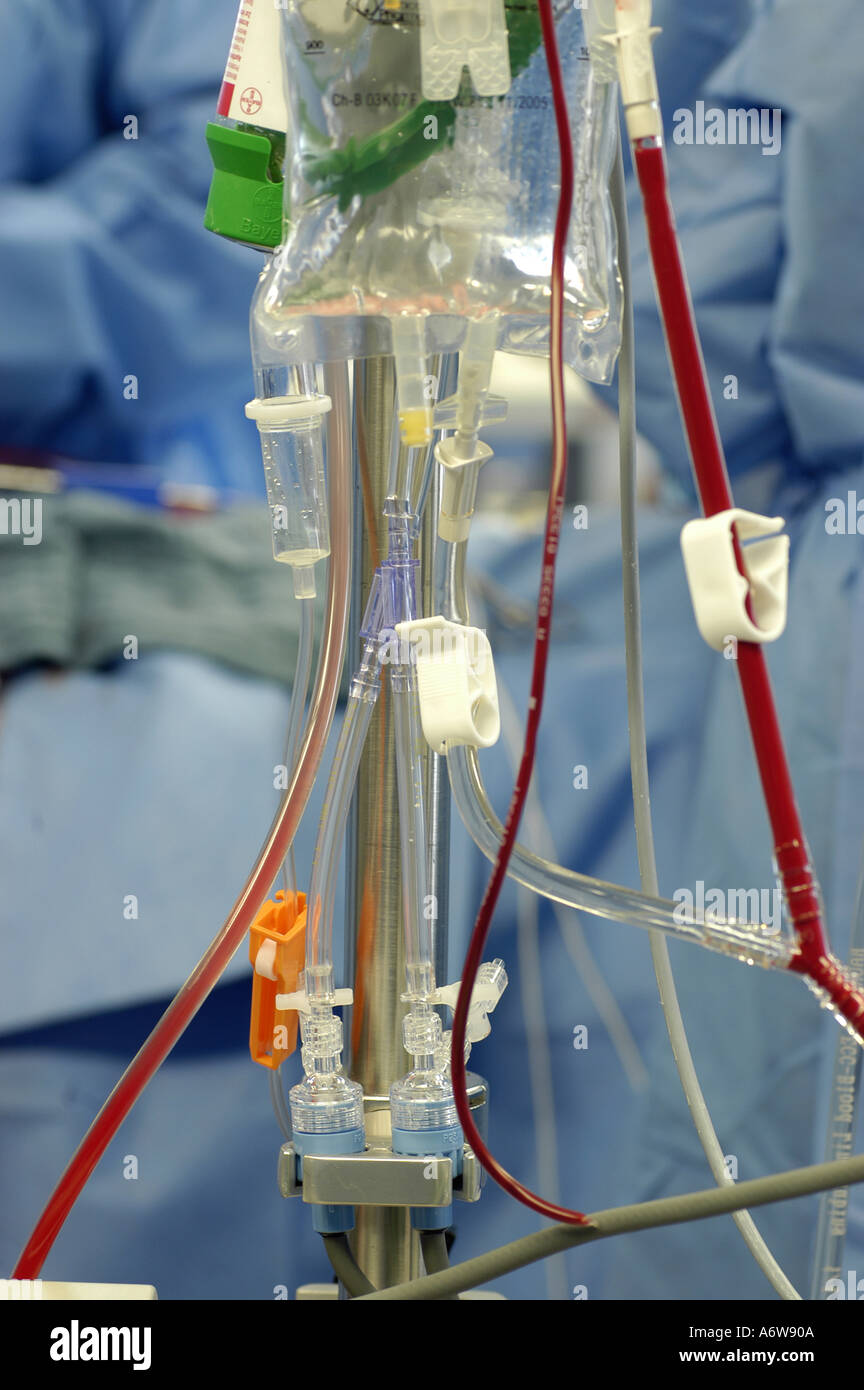 DEU Deutschland Westdeutsches Herzzentrum Essen Klinik fuer Thorax und Kardiovaskulare Chirurgie DEU Germania Essen Centro di cuore della Germania Ovest clinica per chirurgia toracica e cardiovascolare WICHTIG Fotos duerfen nicht fuer Werbung PR anderer Kliniken Krankenhaeuser eingesetzt werden Foto Stock