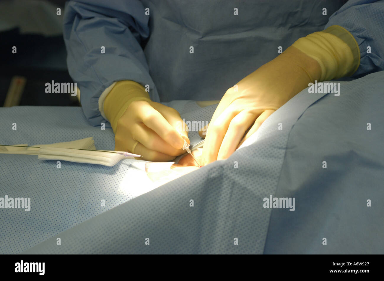 DEU Deutschland Westdeutsches Herzzentrum Essen Klinik fuer Kardiologie Hybridraum Herzkatheter Untersuchung DEU Germania Essen Centro di cuore della Germania occidentale clinica per cardiologia esame catetere intracardiaco in camera ibrida WICHTIG Fotos duerfen nicht fuer Werbung PR anderer Kliniken Krankenhaeuser eingesetzt werden Foto Stock