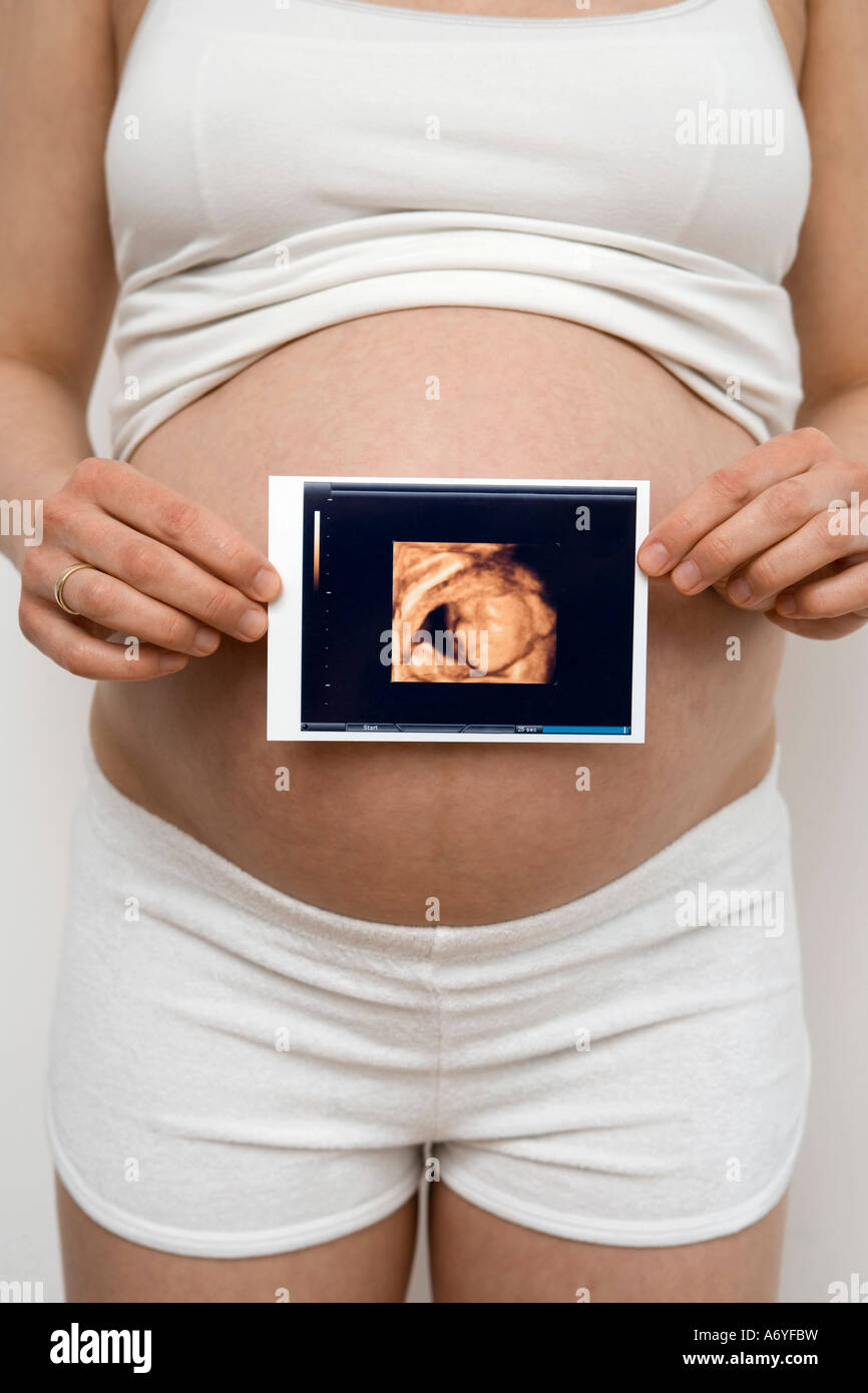 Donna incinta in possesso di una immagine ad ultrasuoni Foto Stock