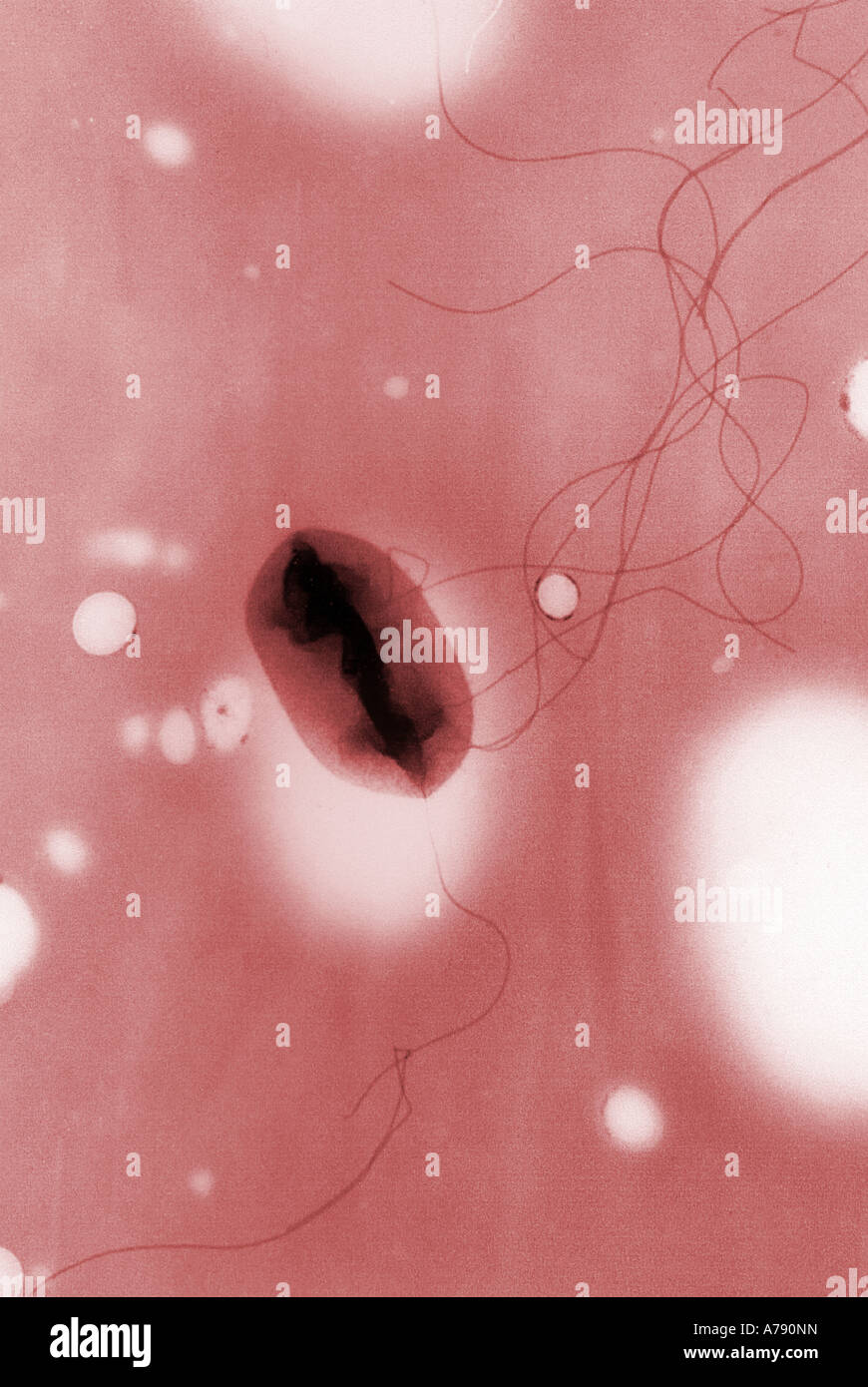 Microscopio elettronico a trasmissione di E coli O157 H7 mostra flagelli Pseudoreplica tecnica Foto Stock