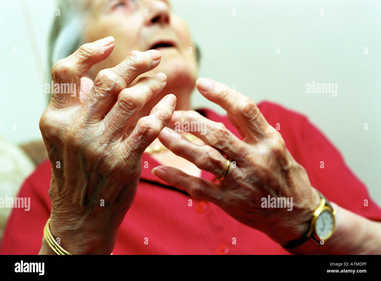 Artrite donna, Close up di un signore anziane mani artritiche Foto Stock