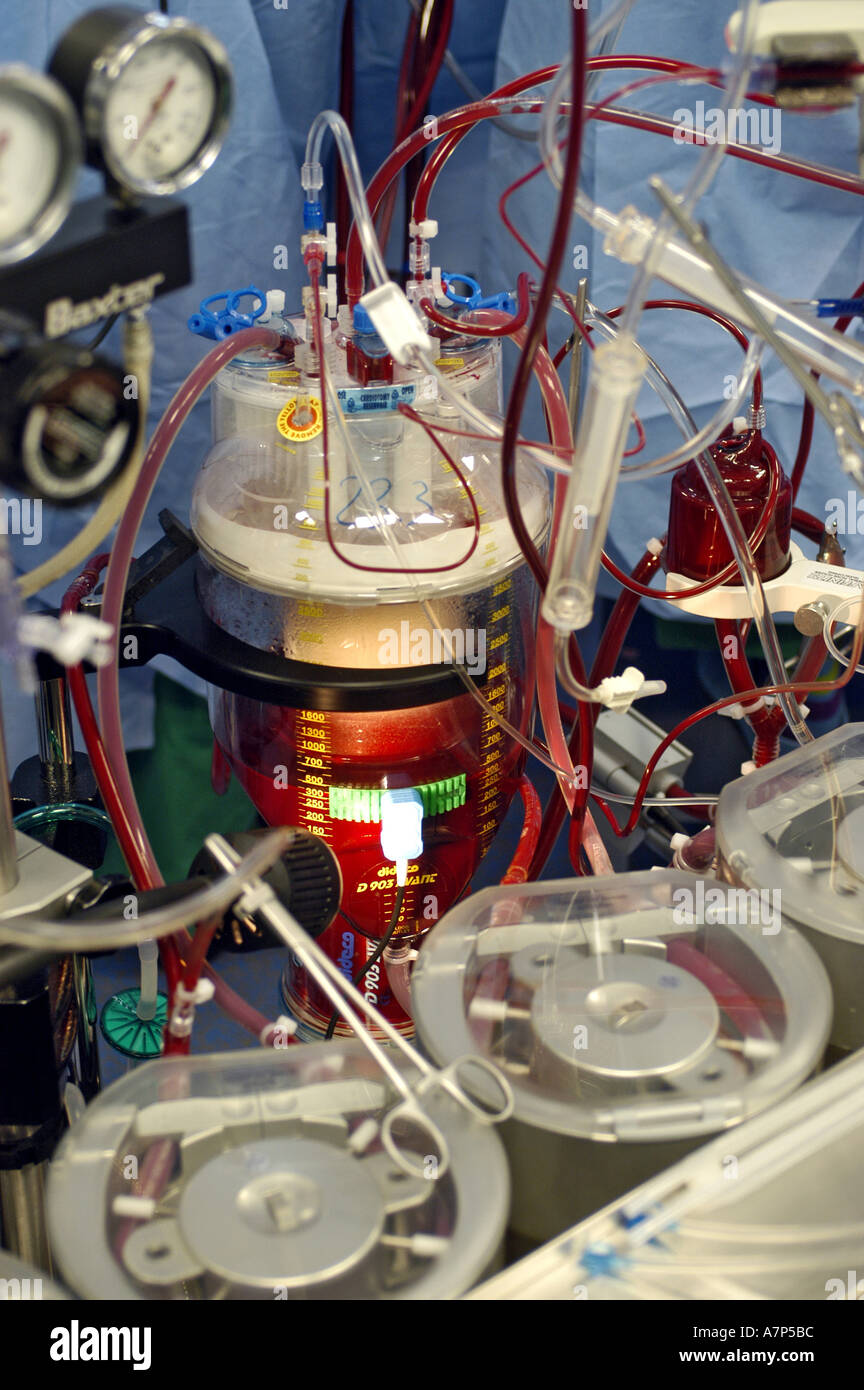 DEU Deutschland Westdeutsches Herzzentrum Essen Klinik fuer Thorax und Kardiovaskulare Chirurgie Herz Lungen Maschine DEU Germania Essen Centro di cuore della Germania Ovest clinica per torace e chirurgia cardiovascolare rianimazione cardiopolmonare WICHTIG Fotos duerfen nicht fuer Werbung PR anderer Kliniken Krankenhaeuser eingesetzt werden Foto Stock