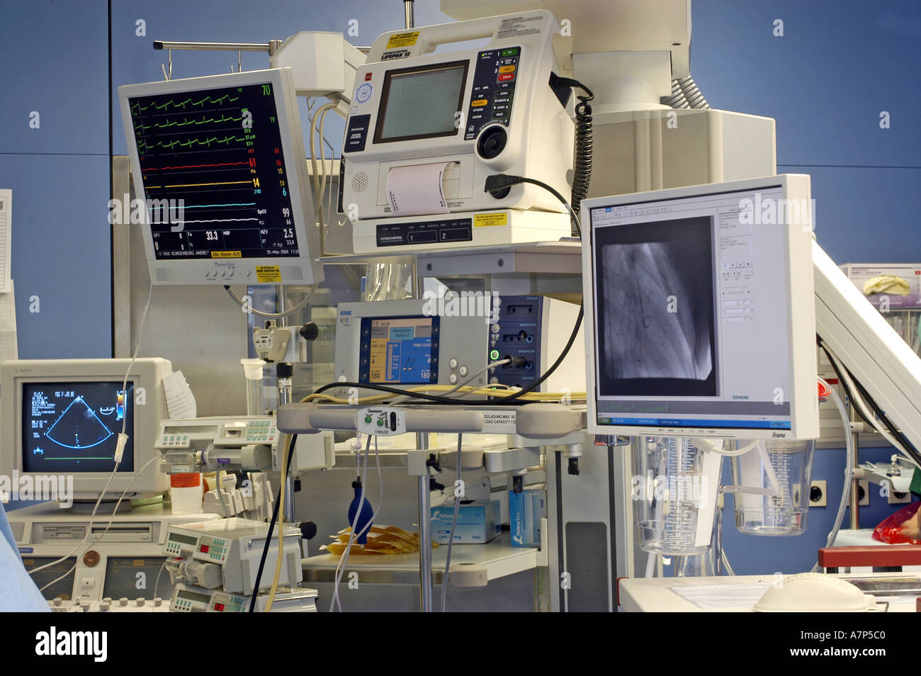 DEU Deutschland Westdeutsches Herzzentrum Essen Klinik fuer Thorax und Kardiovaskulare Chirurgie Geraeteampel DEU Germania Essen Centro di cuore della Germania Ovest clinica per torace e chirurgia cardiovascolare rianimazione cardiopolmonare WICHTIG Fotos duerfen nicht fuer Werbung PR anderer Kliniken Krankenhaeuser eingesetzt werden Foto Stock